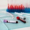 Encontrar tests rápidos y fiables para el Alzheimer es una misión clave para la ciencia. Y tenemos un nuevo candidato